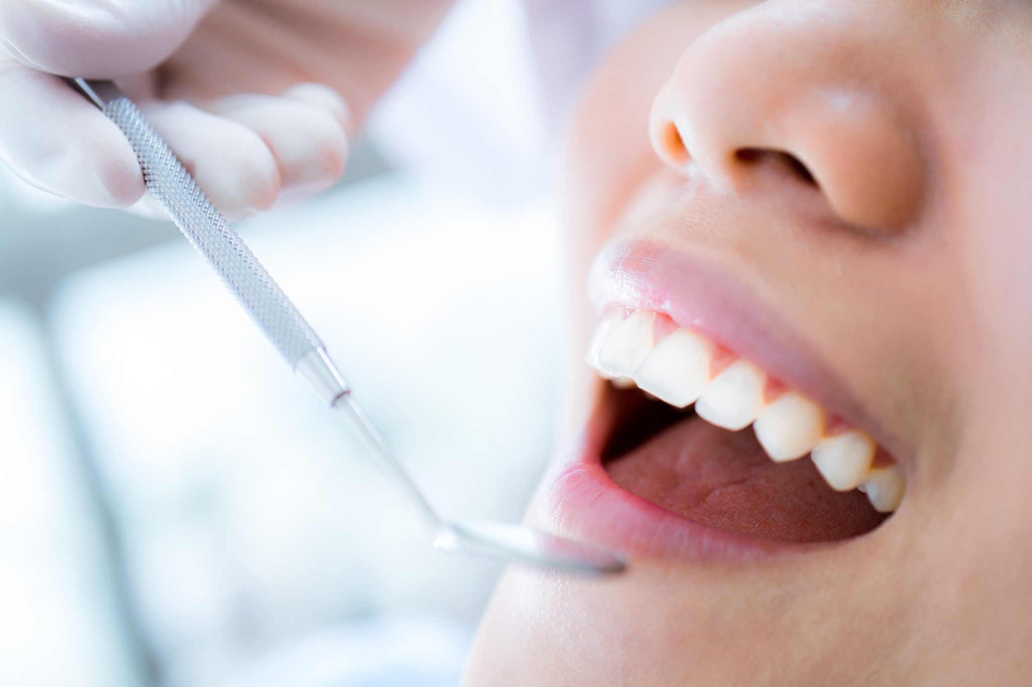 Sedation Dentistry In Columbus Dental Anxiety